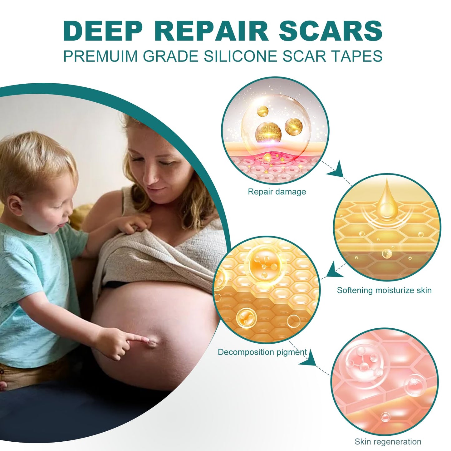SLUKHIG Silicone Scar Sheets Roll 2M – Reusable Scar Tape for C-Section & Surgical Scars
