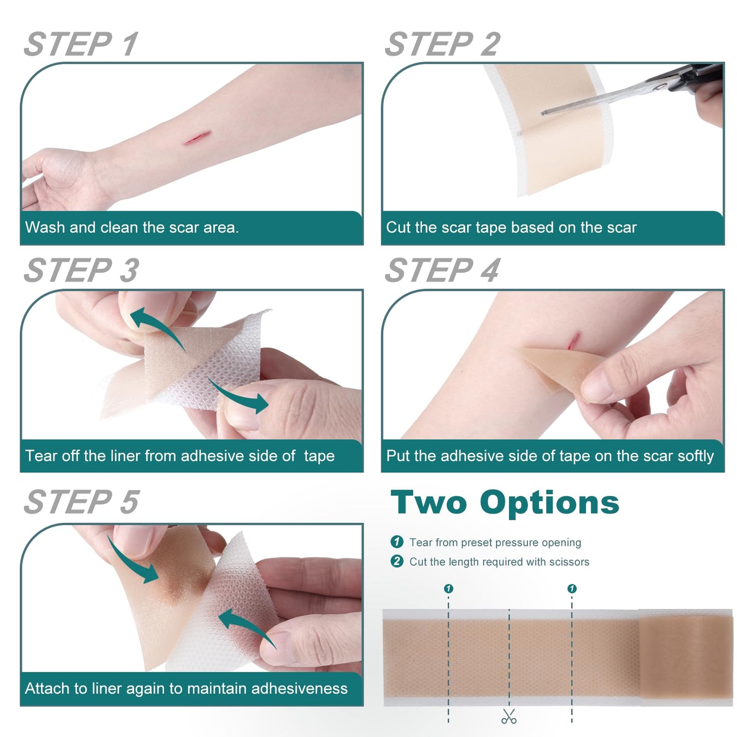 SLUKHIG Silicone Scar Sheets Roll 2M – Reusable Scar Tape for C-Section & Surgical Scars