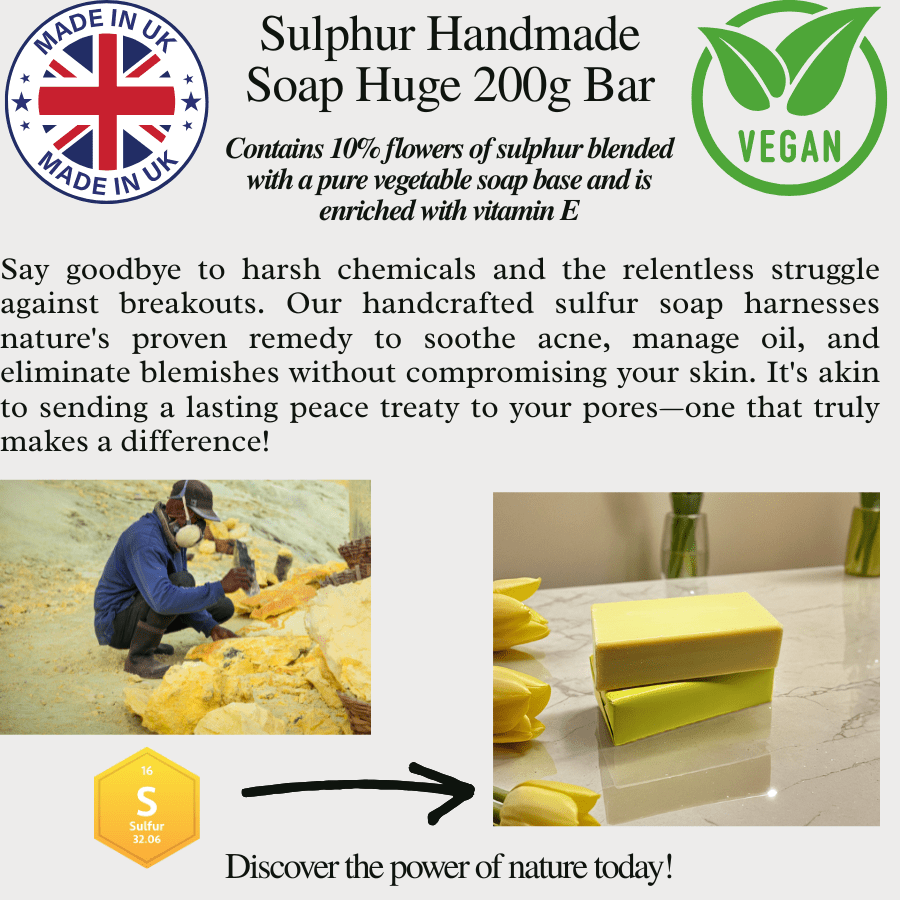5 x Sulphur Soap Bars – Best Sulphur Acne Treatment for Eczema, Scabies & Skin Fungus – Handmade in the UK – Only £24.99 with Free P&P