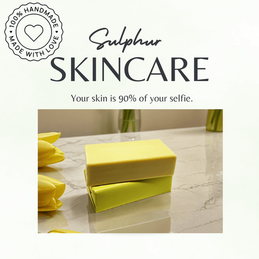 Sulphur Soap Bar 200g – Natural Acne, Rosacea, Eczema & Fungal Treatment UK