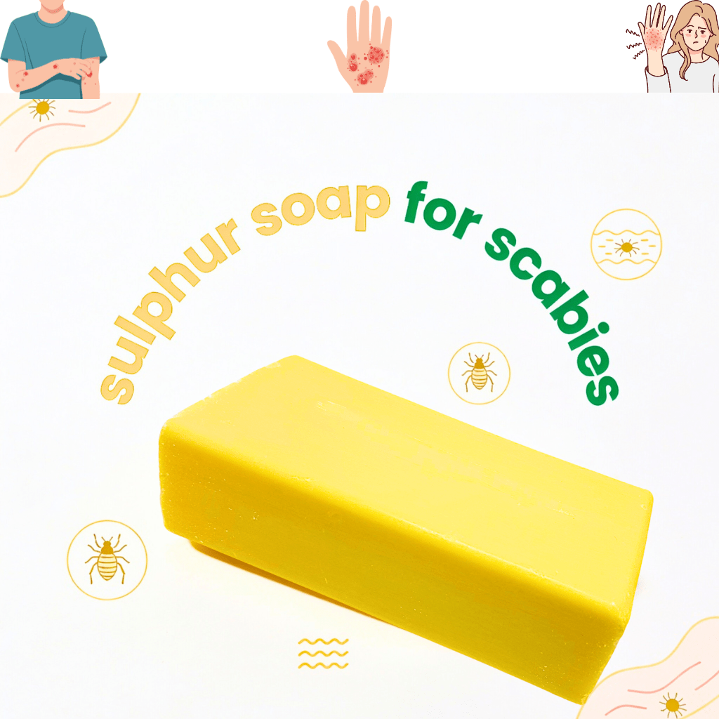 10% Sulphur Soap (200g) for Acne, Rosacea, Eczema & Scabies Relief
