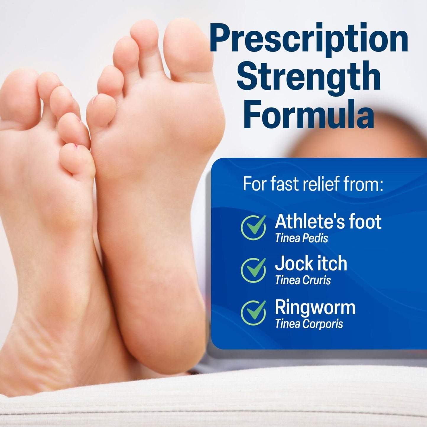TARO Terbinafine 1% Anti-Fungal Cream – Athlete’s Foot Treatment (Pack of 2)