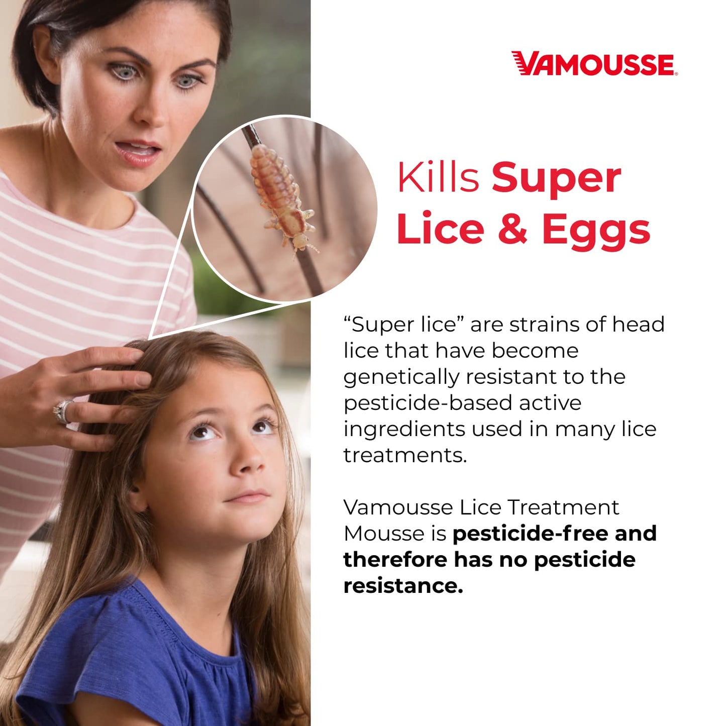 Vamousse Lice Treatment Mousse – Pesticide-Free, Non-Toxic, Kills Super Lice & Eggs (6 oz)