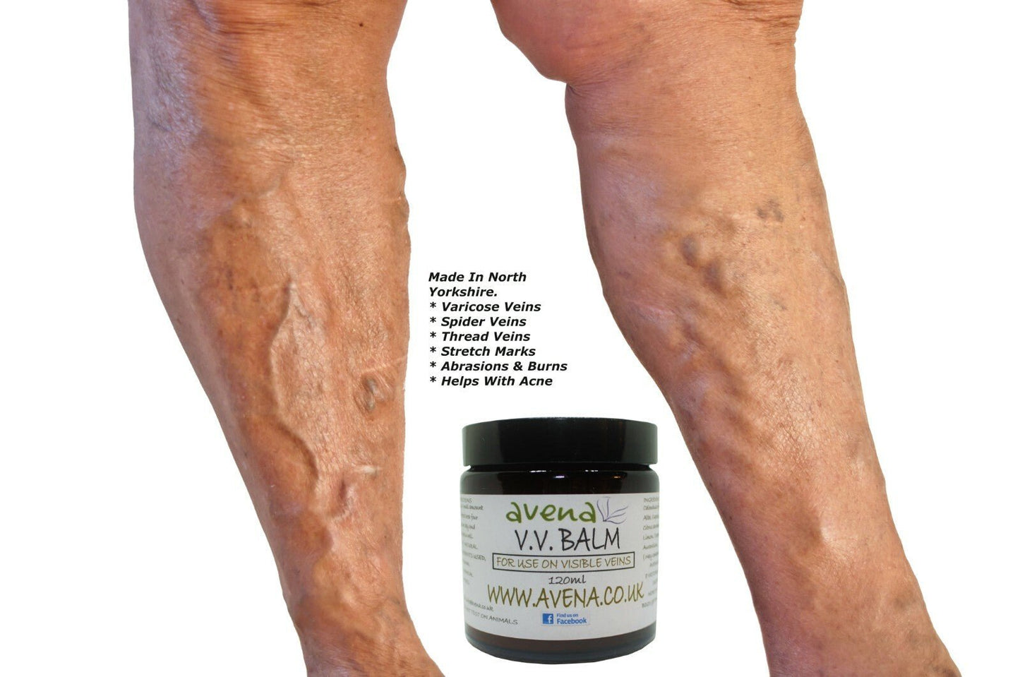Varicose Vein Cream Vein Care Fading Cream Vein Cream Spider Veins Scars Soothe